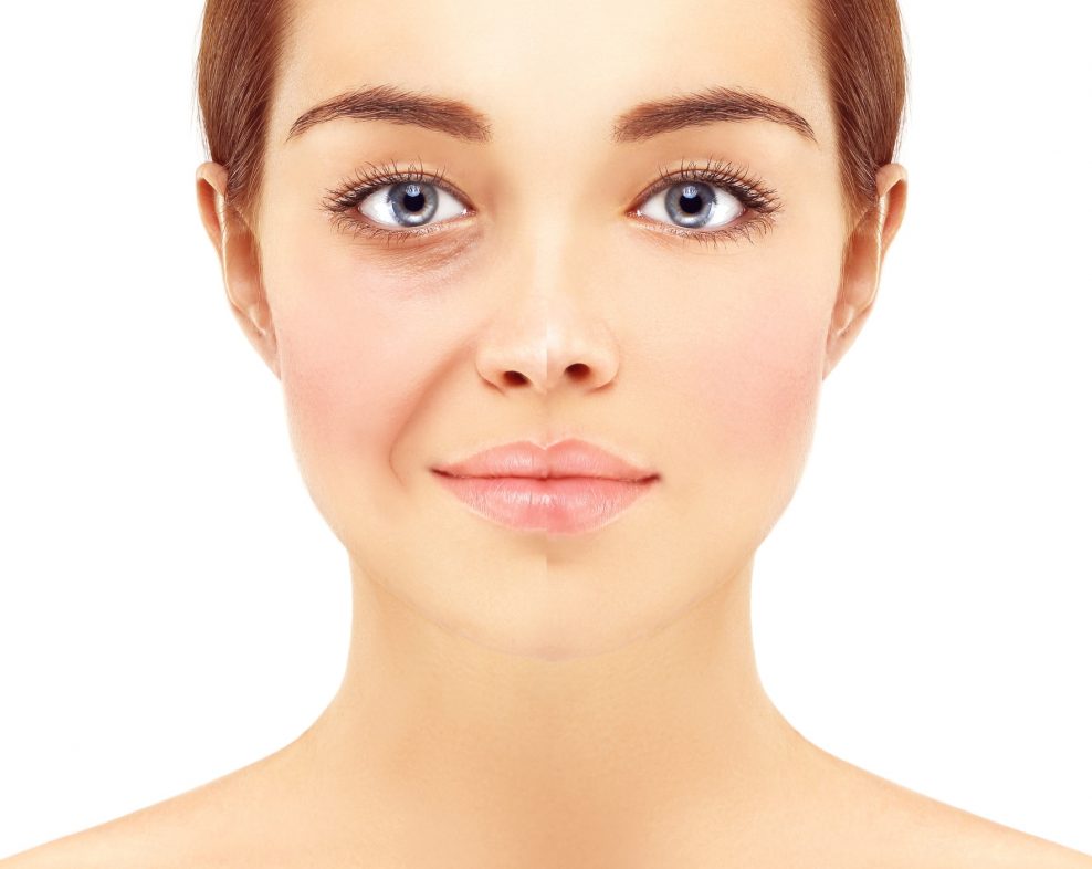 Visage